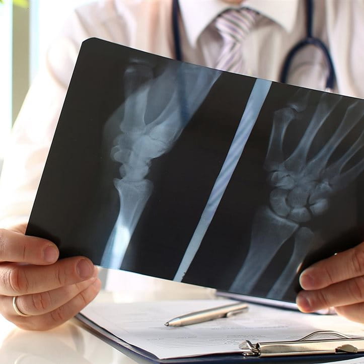 Ein Arzt sitzt am Tisch und betrachtet ein Röntgenbild